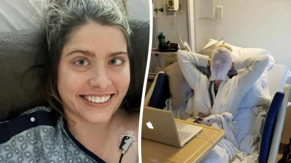 Volleyball accident reveals womanβs rare condition leaving her with multiplying tumors